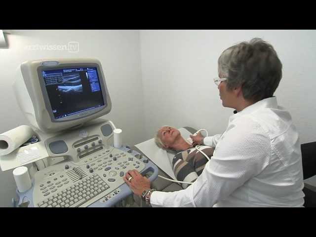 Hier sehen Sie, wie eine Ultraschalluntersuchung der Halsschlagader vor sich geht.

Mehr Gesundheitsvideos auf http://www.arztwissen.tv