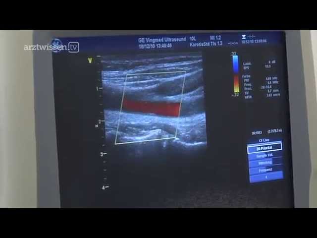 Ultraschalluntersuchung der Halsschlagader
Dr. med. Petra Lange-Braun
